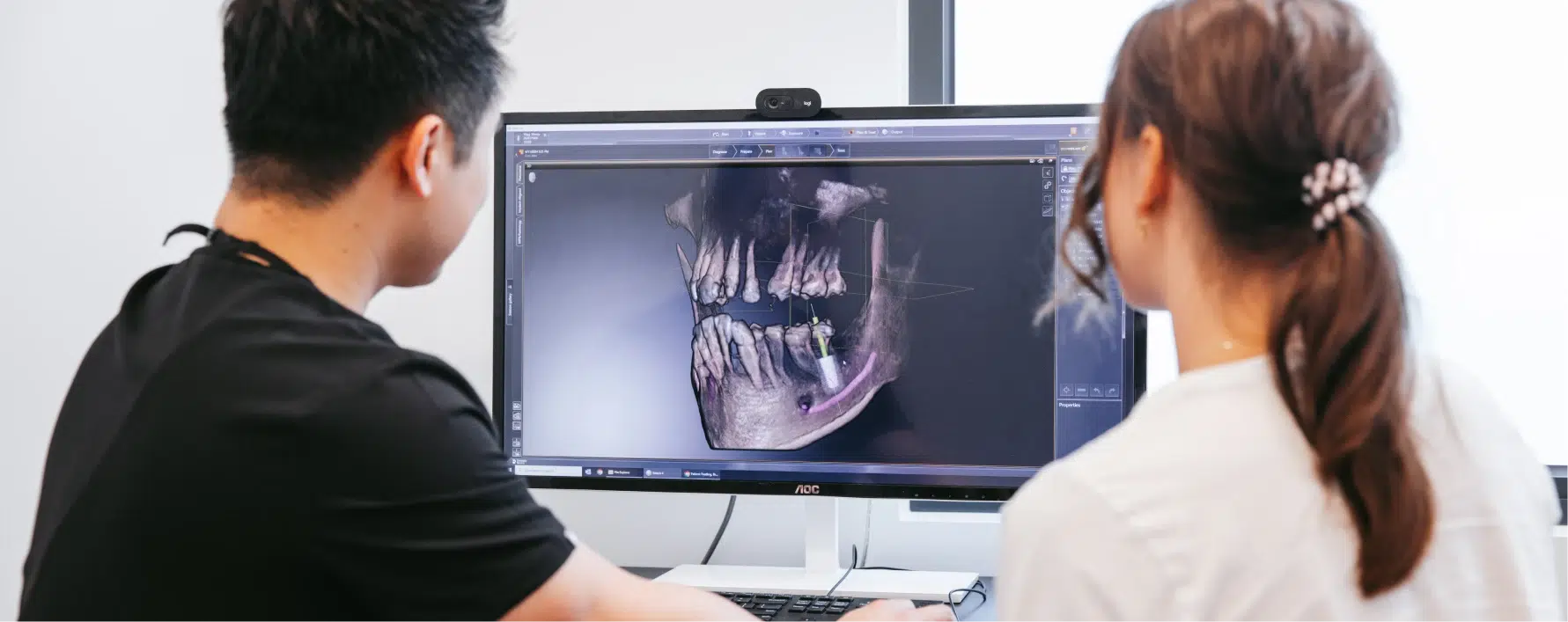 Dental Implants In Smile Lounge Dental Implants In Smile Lounge