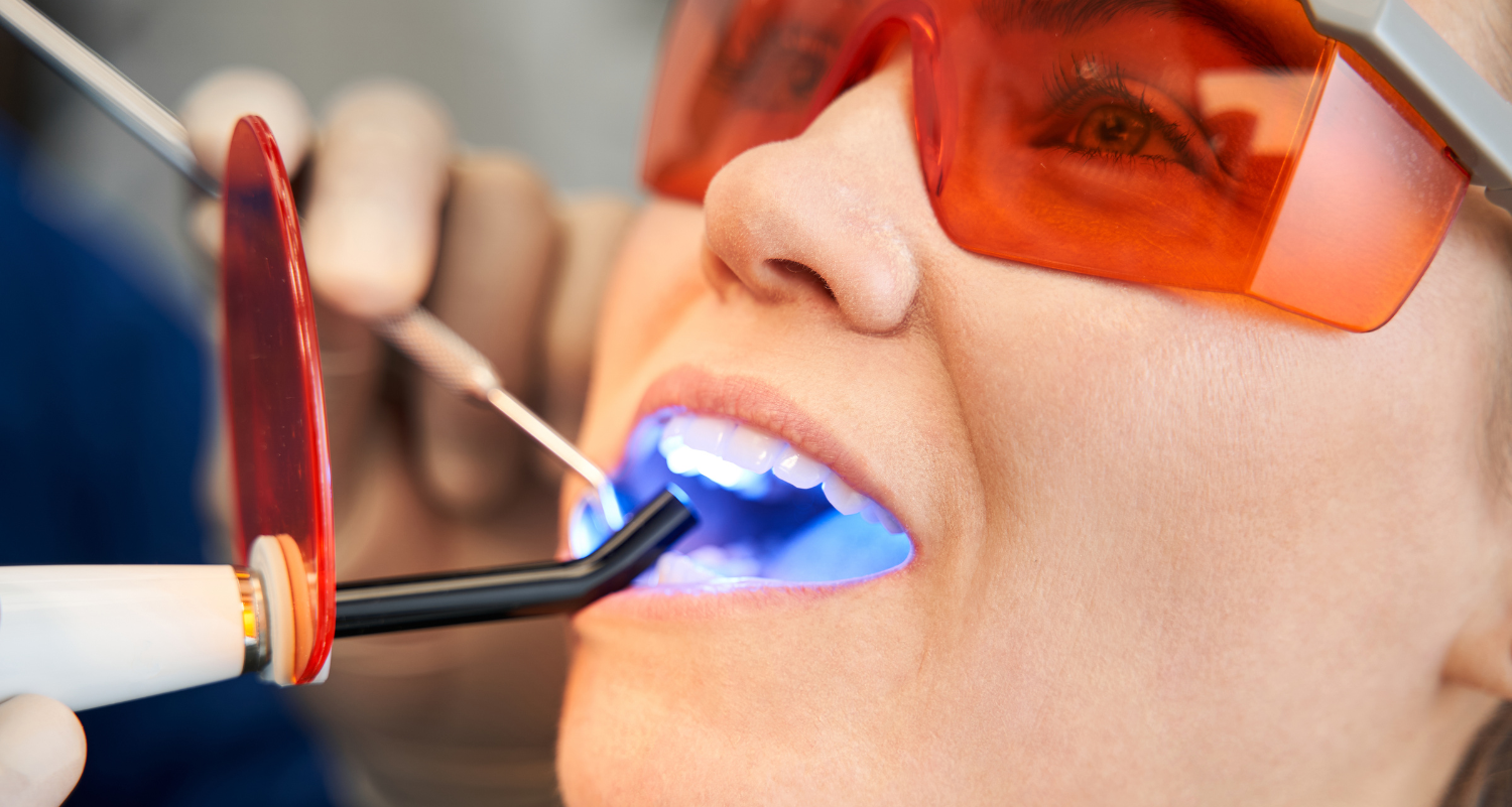 Tooth Fillings for Sensitivity: Treatment Options for Decay and Exposed Roots
