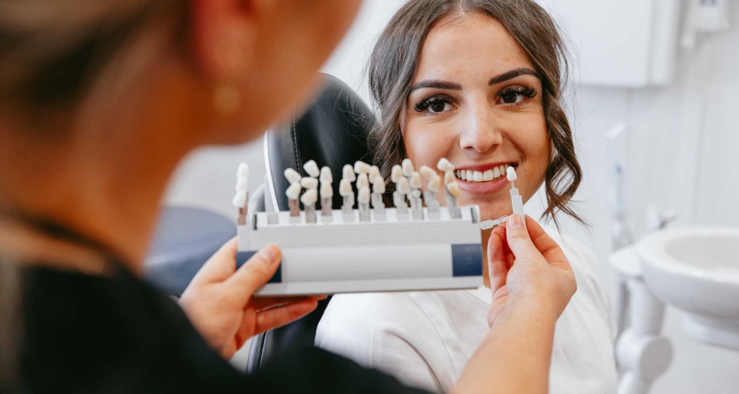 Aesthetic CEREC Veneers Guide