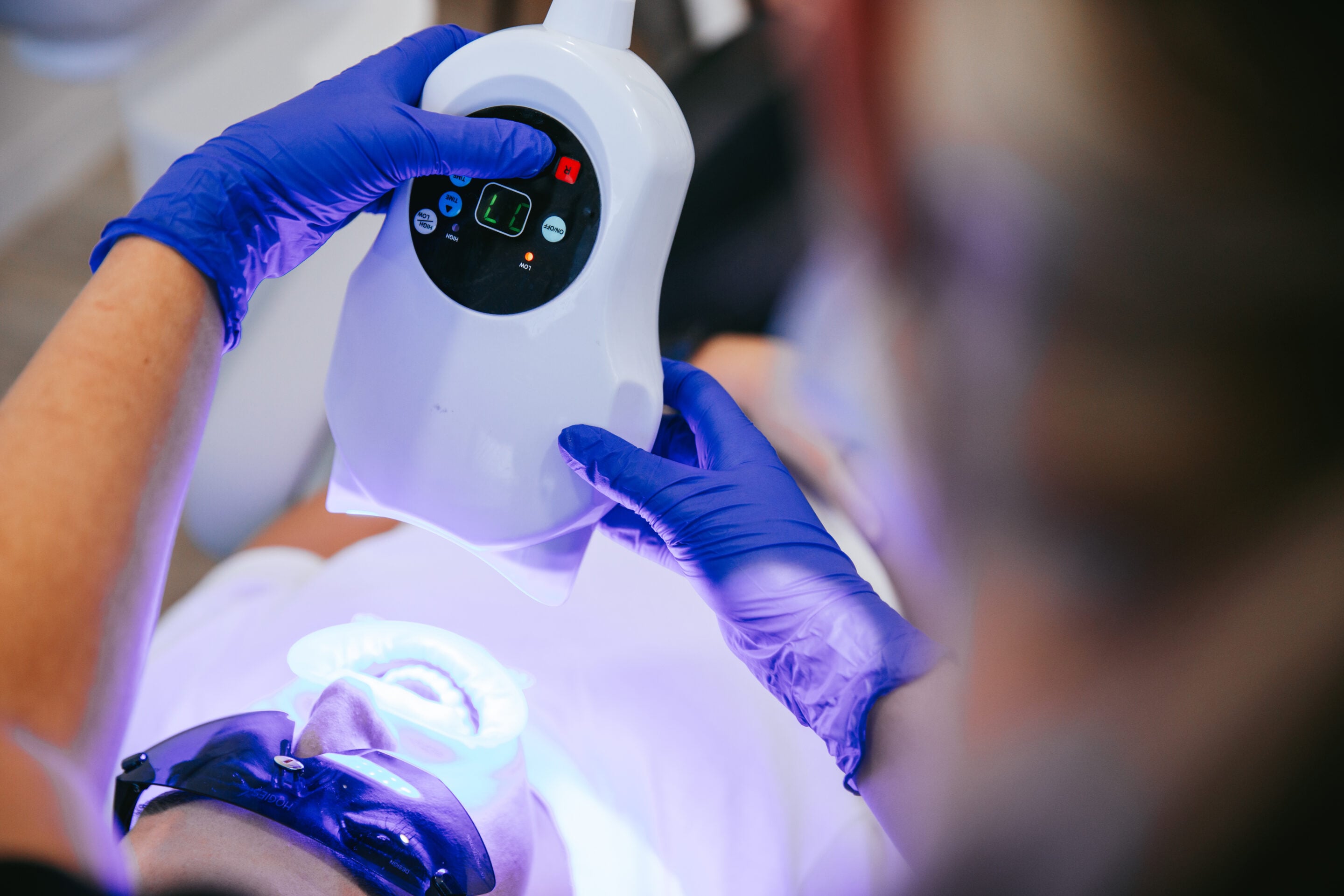 Best Reviews for Teeth Whitening in 3805? Here Is How to Read Them Properly