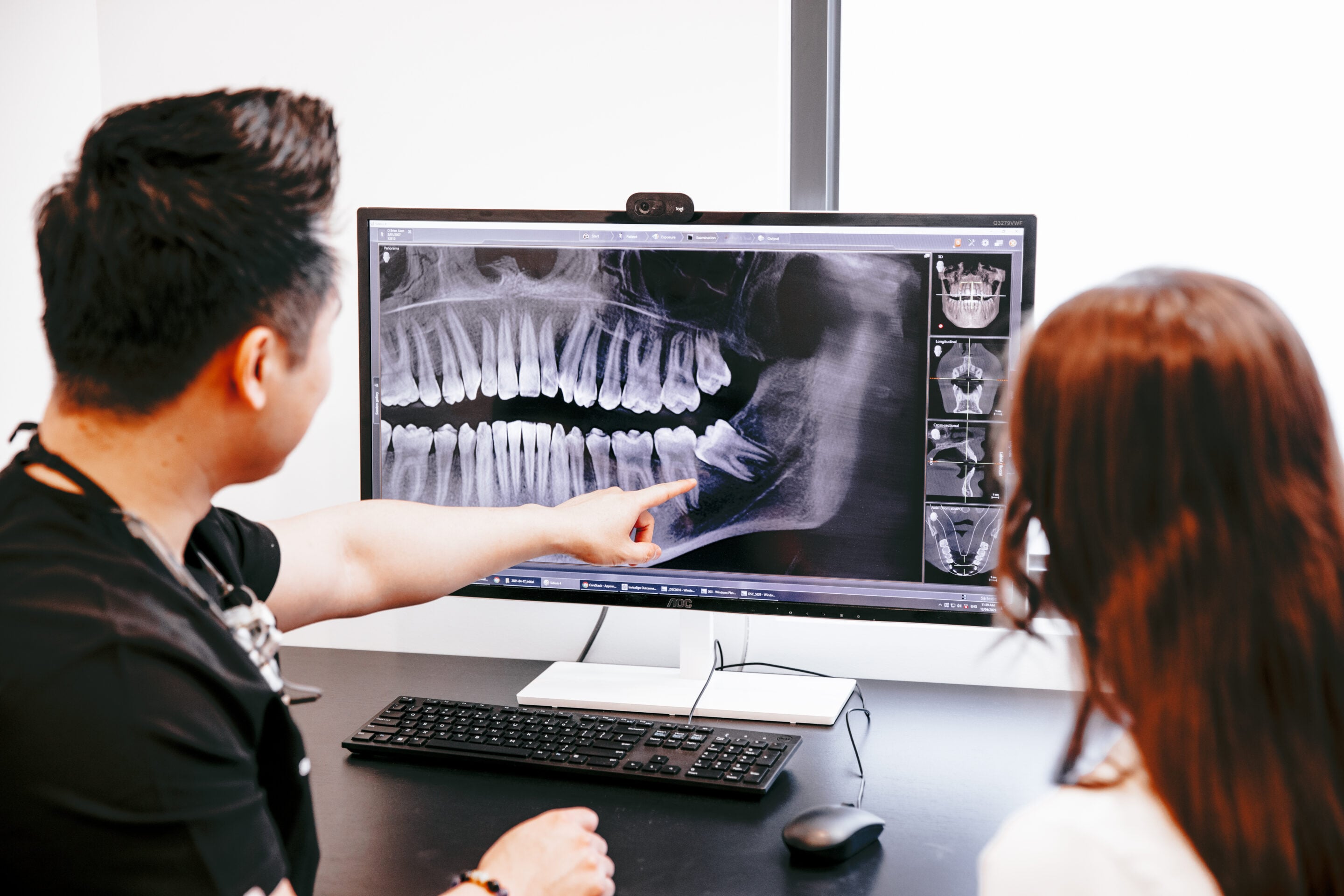 Best Dentist for Wisdom Tooth Removal Near Narre Warren? Start With the Right Question