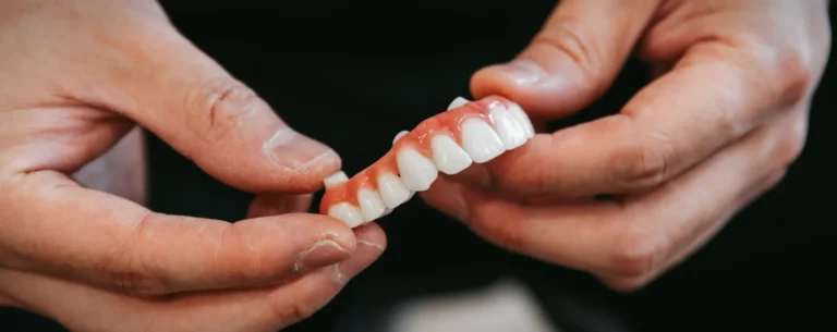 All-Teeth-On-4 full-arch dental implant treatment at Smile Lounge