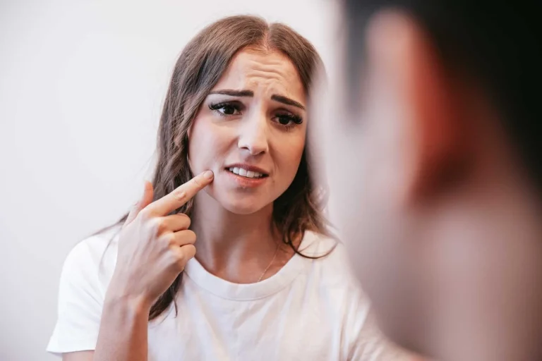 Heal Your Bleeding Gums in Narre Warren