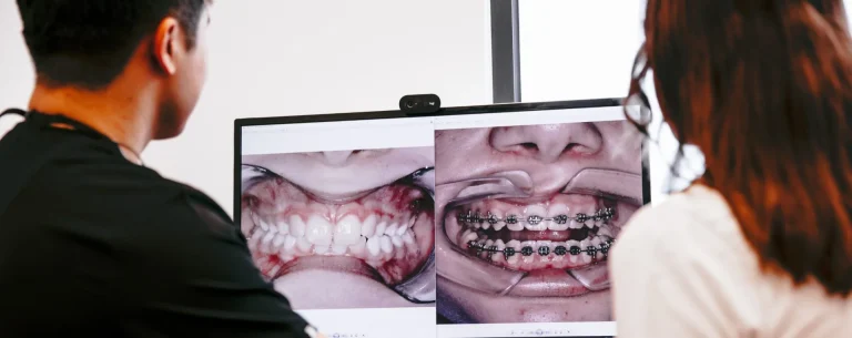 Braces at Smile Lounge in Narre Warren, Melbourne