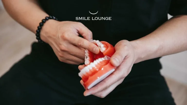 Braces vs Angel Aligners?
