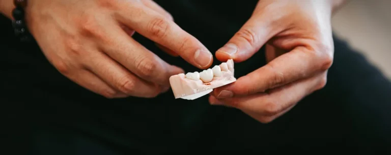 Dental Crowns and Bridges at Smile Lounge in Narre Warren, Melbourne