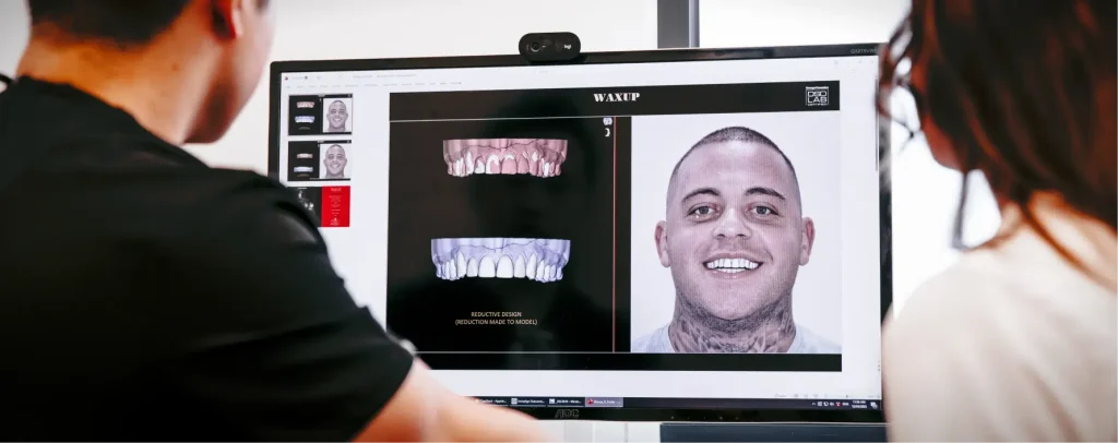 Digital Smile Design at Smile Lounge in Narre Warren, Melbourne