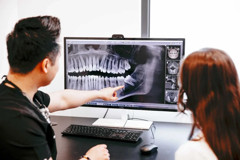 Gentle Wisdom Teeth Removal for Local Patients