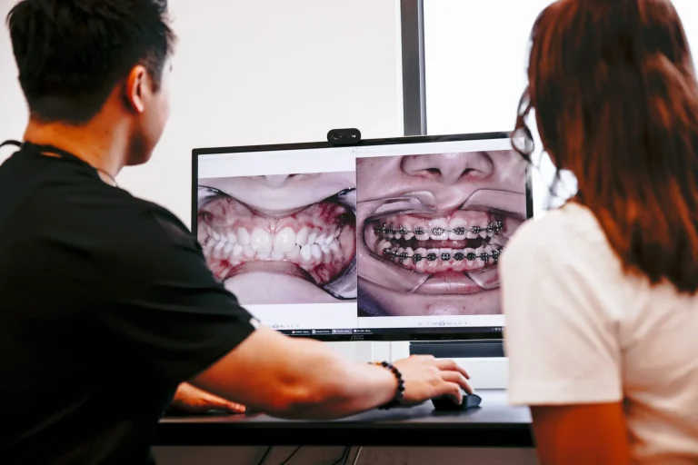 Getting Your Braces Off In Narre Warren
