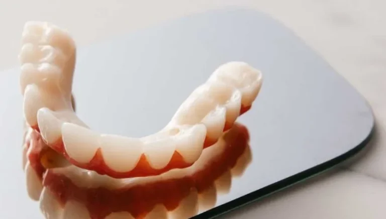 The Final Fitting Of A Partial Denture