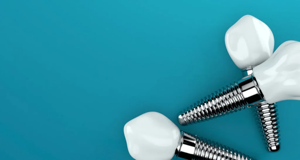 Dental Implants: Preventing a “Sunk-In” Facial Appearance After Tooth Loss
