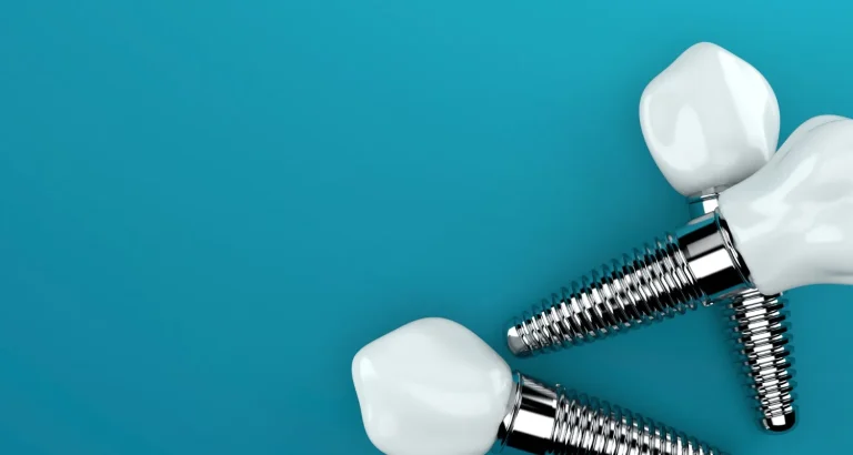 Dental Implants: Preventing a “Sunk-In” Facial Appearance After Tooth Loss