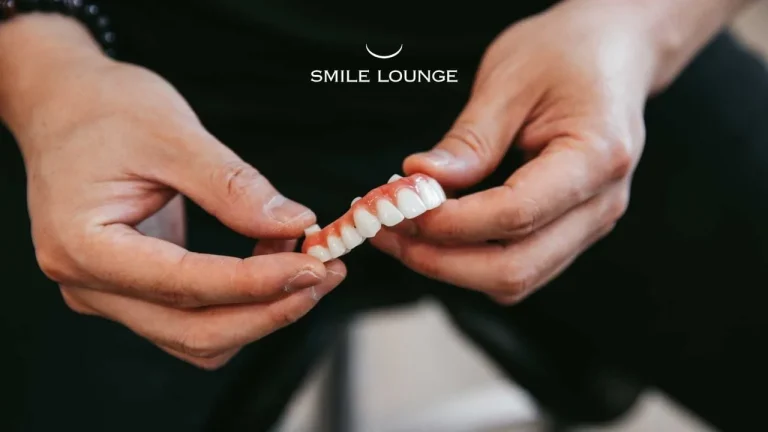 What Is the Cost of All-Teeth-On-Four Implants?