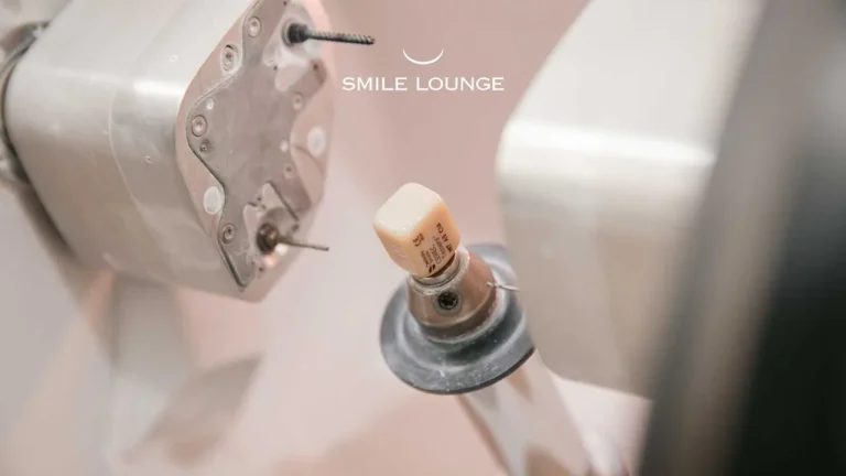 What Is the Cost of Dental Crown?