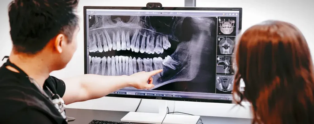 Wisdom teeth removal treatment at Smile Lounge in Narre Warren