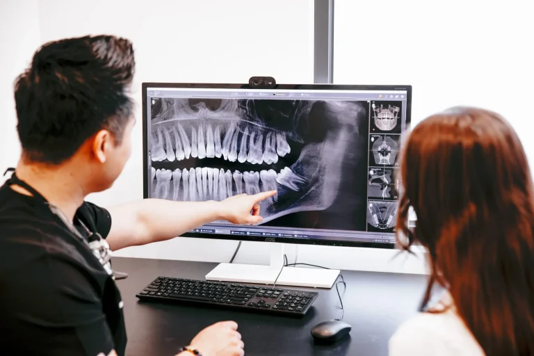 Best Dentist for Wisdom Tooth Removal Near Narre Warren? Start With the Right Question